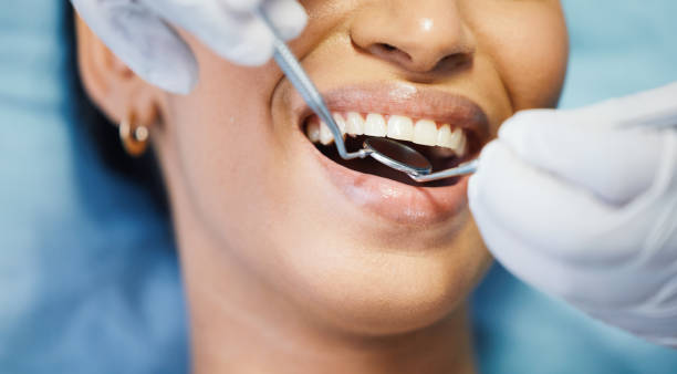 Best Lost Filling or Crown Replacement in Fairhope, AL